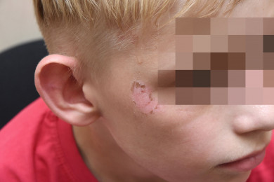 Воронежца арестовали за истязание пасынка