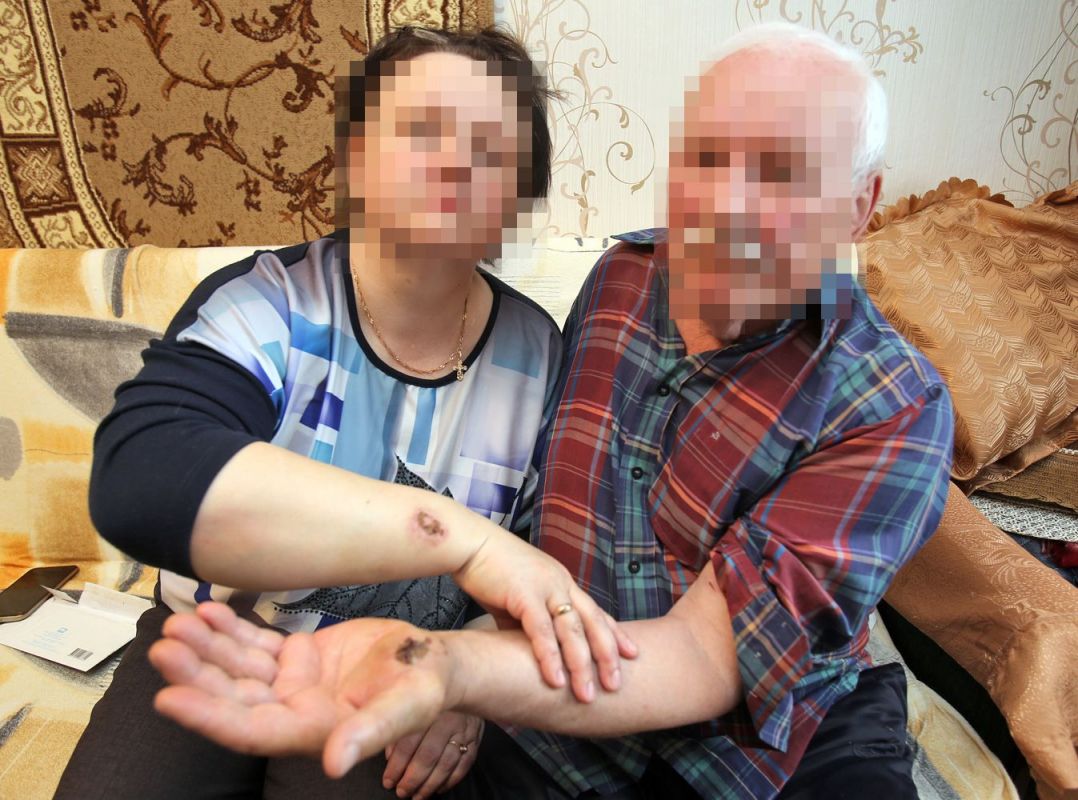 «Она ему рот рвала и глаза выдавливала!»: в Воронежской области произошла битва соседей