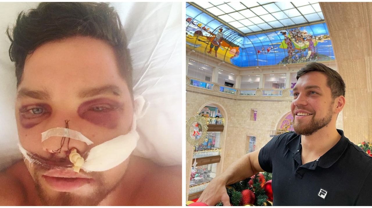 На фото Роман в больнице сразу после инцидента и после выписки