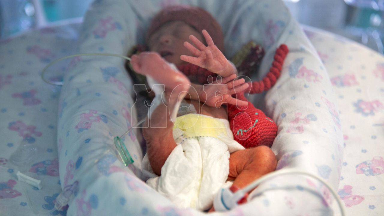 «Моя девочка сильная и&nbsp;долгожданная — она справится!» Воронежские врачи спасли ребёнка весом 510 граммов