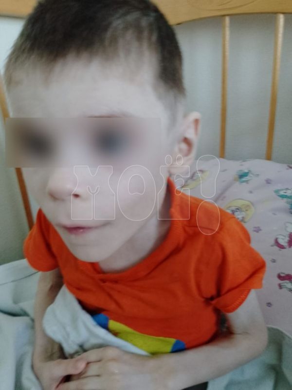 Мать истощённого шестилетнего мальчика стала фигуранткой уголовного дела в&nbsp;Воронеже