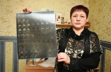 После операции жительница Воронежа обнаружила у себя «удалённые» органы