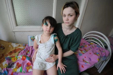 В Воронеже покусанную псом девочку выписали из больницы