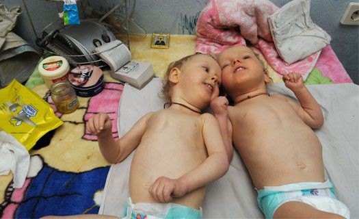 В Воронеже многодетная мать пытается спасти жизни двойняшек
