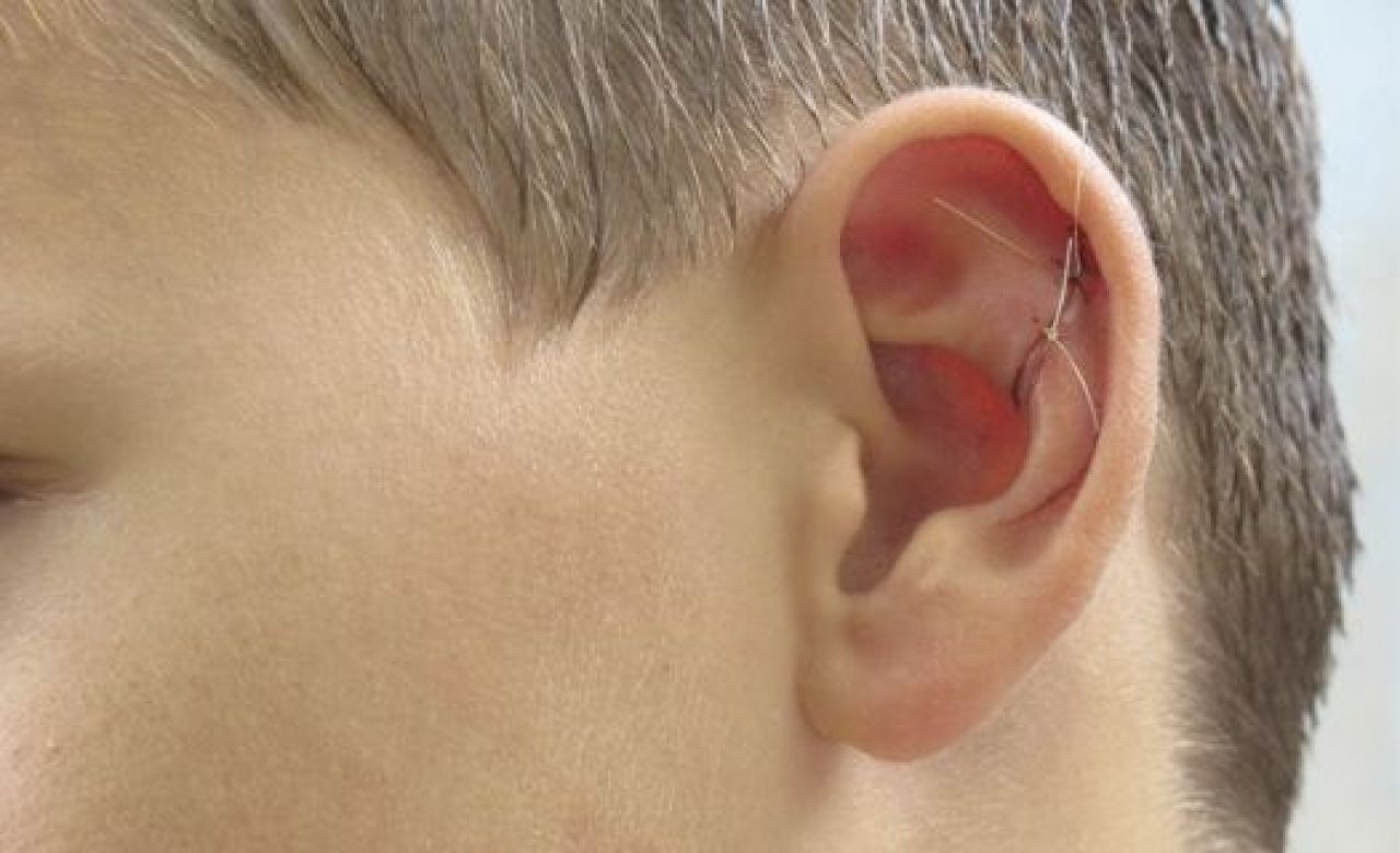 прокусанное ухо пострадавшего подростка