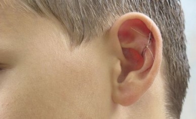 На мужчину, который избил ребенка из-за поцарапанного авто, завели дело