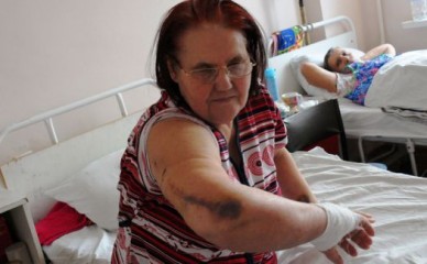 Пострадавшая от бульдога пенсионерка: «Если бы не муж, собака меня бы загрызла»