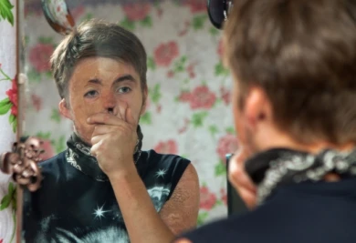 15-летнему подростку необходима помощь в лечении ожогов после пожара