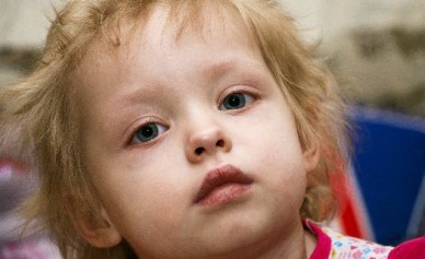 Настя Ежова вернулась в Воронеж после полугодового лечения в Германии