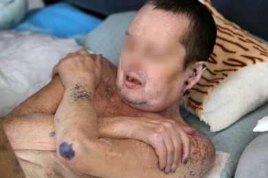 Умоляющий об эвтаназии житель Воронежа попал на федеральный канал