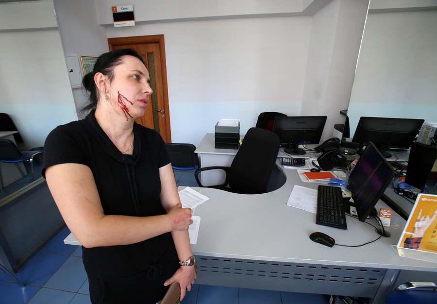 &laquo;Буду добиваться от банка компенсации за своё испорченное лицо&raquo;
